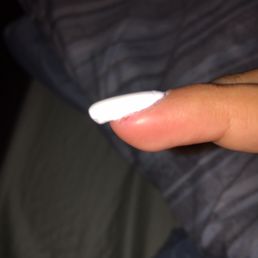 Swollen,,, Swollen,,,