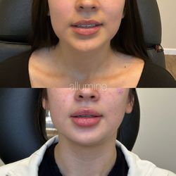 Allumine Skin Clinic