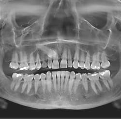 Atlantic Dental Arts - Digital X-rays and Digital Panoramic machine on site for immediate processing of your x-rays.