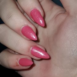 V Nails & Spa - My skinned up fingers
