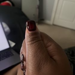 Nail Care & Spa - Swollen cuticle , nail uneven and already looks slightly grown out despite it being only 3days
