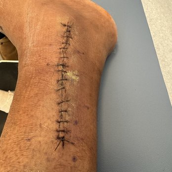 OrthoMaryland - Surgical incision - Orthopedists Near Me - Baltimore, Maryland