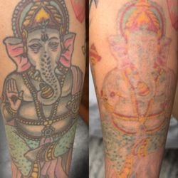 Allure laser Tattoo Removal - After 3 sessions, removed black ink only