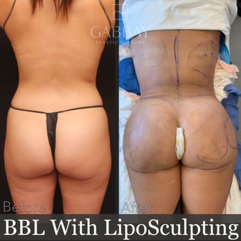 Gabbay Plastic Surgery - Cosmetic Surgeons Near Me - Beverly Hills, California Gabbay Plastic Surgery - Cosmetic Surgeons Near Me - Beverly Hills, California