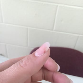 Pro Nails - It's since healed up but it was really bad when she cut my nail (Annie didn't do this) - Nail Salons Near Me - North Highlands, California Pro Nails - It's since healed up but it was really bad when she cut my nail (Annie didn't do this) - Nail Salons Near Me - North Highlands, California