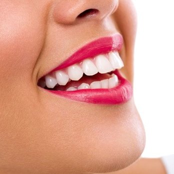 Spinel Dental - Cosmetic & Aesthetic Dentistry - General Dentistry Near Me - Hamilton, Ontario Spinel Dental - Cosmetic & Aesthetic Dentistry - General Dentistry Near Me - Hamilton, Ontario
