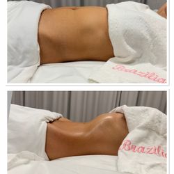 Brazilian Body Sculpting - Sculpting Detox