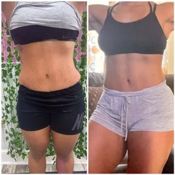 Lash&Body Esthetics By Kiya - Ice Sculpt, Cavi Lipo & Wood Therapy