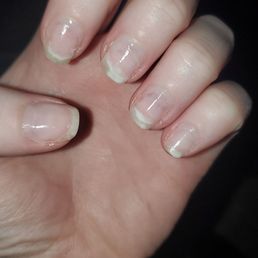 My nails after acrylics were pryed off. I added a top coat with healing properties when I got home.
