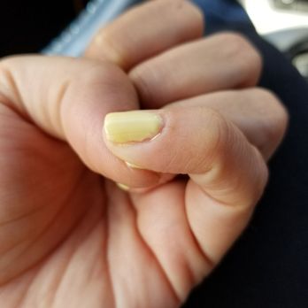 Signature Nails 2 - The service was good but polish was terribly applied. - Skin Care Near Me - Hialeah, Florida Signature Nails 2 - The service was good but polish was terribly applied. - Skin Care Near Me - Hialeah, Florida