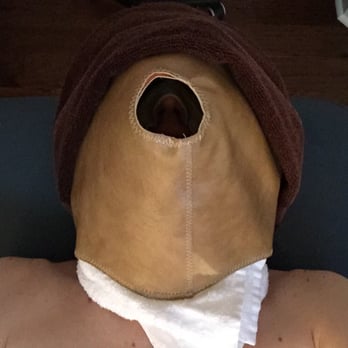 Dermaspace - The human yucca volcano a la Hannibal. Ah, toasty. - Skin Care Near Me - Seattle, Washington