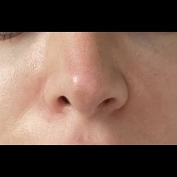Jay Calvert, MD - Cosmetic Surgeons Near Me - Beverly Hills, California