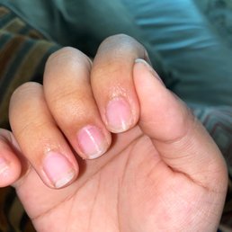 Poorly filed nail!