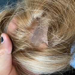 Gayla Wigs - Bald spot