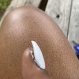Paint on my skin and back of nail that was left on my nails. Paint on my skin and back of nail that was left on my nails.