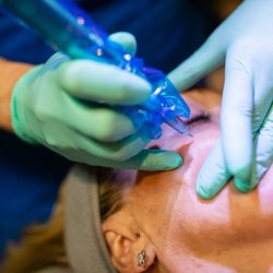 Skintopia - Lorrie Smith performing a microneedling treatment on a client