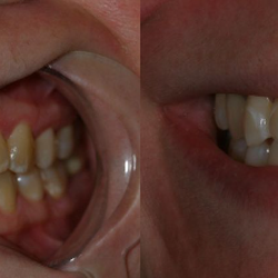 The Office of Keith G. Lorio - Before & After Results at The Office of Keith G. Lorio, DDS| Baton Rouge, LA