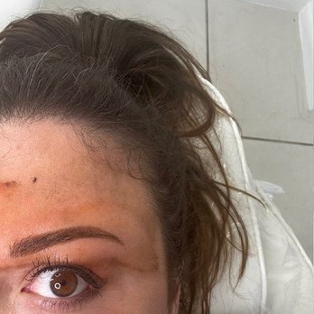 Qtbrows - 11/24/24 - Duringafter my initial 1st appointment (Natural) - Permanent Makeup Near Me Qtbrows - 11/24/24 - Duringafter my initial 1st appointment (Natural) - Permanent Makeup Near Me
