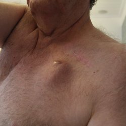 Roberto Pereira, MD