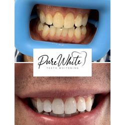 Pure White