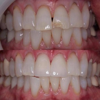 Adam Vaghari, DDS - Cosmetic Dentists Near Me - Laguna Niguel, California Adam Vaghari, DDS - Cosmetic Dentists Near Me - Laguna Niguel, California