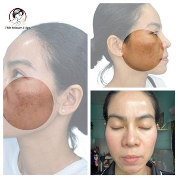 Thile Skincare - facial services, massage therapy near me, skincare treatments - Skin Care Near Me - Duluth, Georgia Thile Skincare - facial services, massage therapy near me, skincare treatments - Skin Care Near Me - Duluth, Georgia