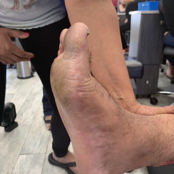 Robertson Nail - BEWARE: My feet AFTER a pedicure. Ivan, the owner, refused to fix it after we confronted him. - Nail Salons Near Me - Beverly Hills, California Robertson Nail - BEWARE: My feet AFTER a pedicure. Ivan, the owner, refused to fix it after we confronted him. - Nail Salons Near Me - Beverly Hills, California
