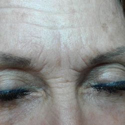Permanent Makeup By Miss Amy Lou - After Skin Needling.  4 sessions.  Notice how soft I look compared to my before picture.  Notice a couple of wrinkles are gone.