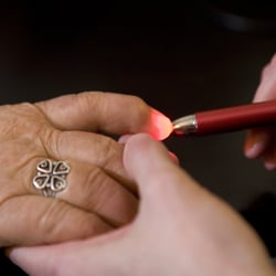 Hayden Acupuncture & Wellness Center - Laser Therapy