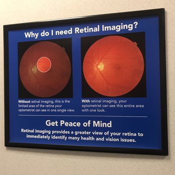 America's Best Contacts & Eyeglasses - Eyewear & Opticians Near Me - Keizer, Oregon America's Best Contacts & Eyeglasses - Eyewear & Opticians Near Me - Keizer, Oregon