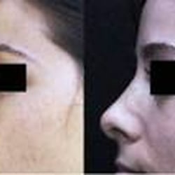Sadove Cosmetic Surgery - Nose Surgery by Sadove