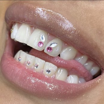 Personal Dental - Gem-fly - Dental Hygienists Near Me Personal Dental - Gem-fly - Dental Hygienists Near Me