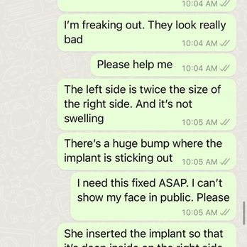 Elite Plastic Surgeon - Proof that this was a problem immediately after placement - Cosmetic Surgeons Near Me - México, D.F., DIF