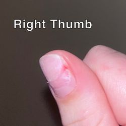 KC Nails & Spa - Torn to the nail bed, bleeding -- and she decided nail glue was a good idea. Stings like hell.