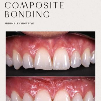 Les Belles - General Dentistry Near Me - New York, New York Les Belles - General Dentistry Near Me - New York, New York