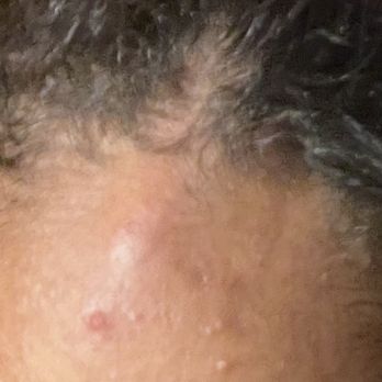 Café Hugo - The hard painful bump the server gave me after hitting me multiple times with his serving tray - French Near Me - Paris, 75