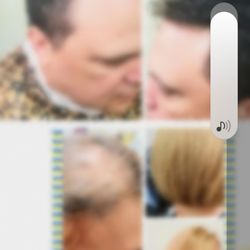 Lucy Vargas Hair Replacement Center - Integracion drl cabello.para damas