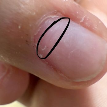 Number 1 Nail Spa - Since the nail drill speed was so high, there is this really deep dent inside my nail now. - Nail Salons Near Me - Brooklyn, New York