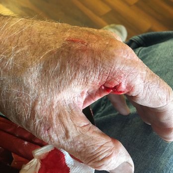 NextCare Urgent Care Albuquerque - The wound and blood shed. - Doctors Near Me - Albuquerque, New Mexico NextCare Urgent Care Albuquerque - The wound and blood shed. - Doctors Near Me - Albuquerque, New Mexico