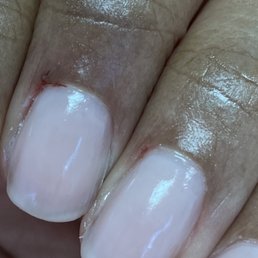 He cut 2 fingers He cut 2 fingers