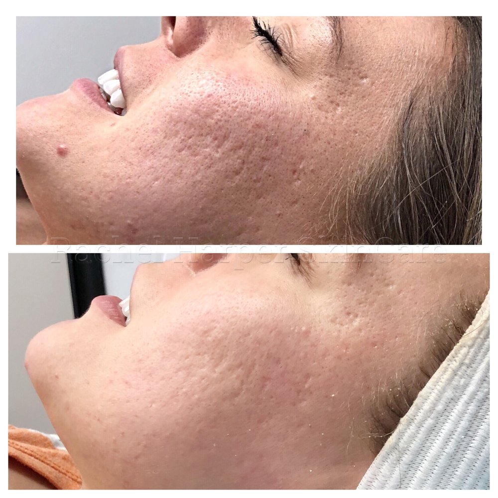 Rachel Harper Skincare Logo