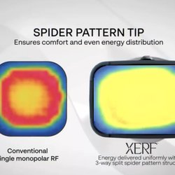 XERF DIFFERENCE