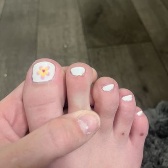 LV Nail Spa - Cut on cuticle of "pointer" toe. - Nail Salons Near Me - Fort Collins, Colorado LV Nail Spa - Cut on cuticle of "pointer" toe. - Nail Salons Near Me - Fort Collins, Colorado