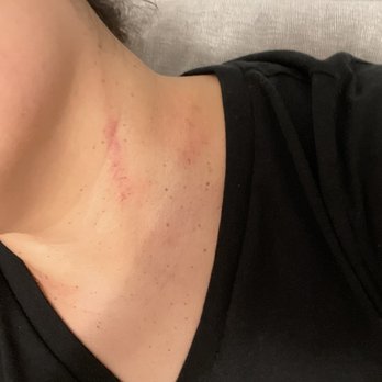 Mysa Day Spa - Rug burns from too much and friction and pressure on my neck - Day Spas Near Me - San Francisco, California Mysa Day Spa - Rug burns from too much and friction and pressure on my neck - Day Spas Near Me - San Francisco, California