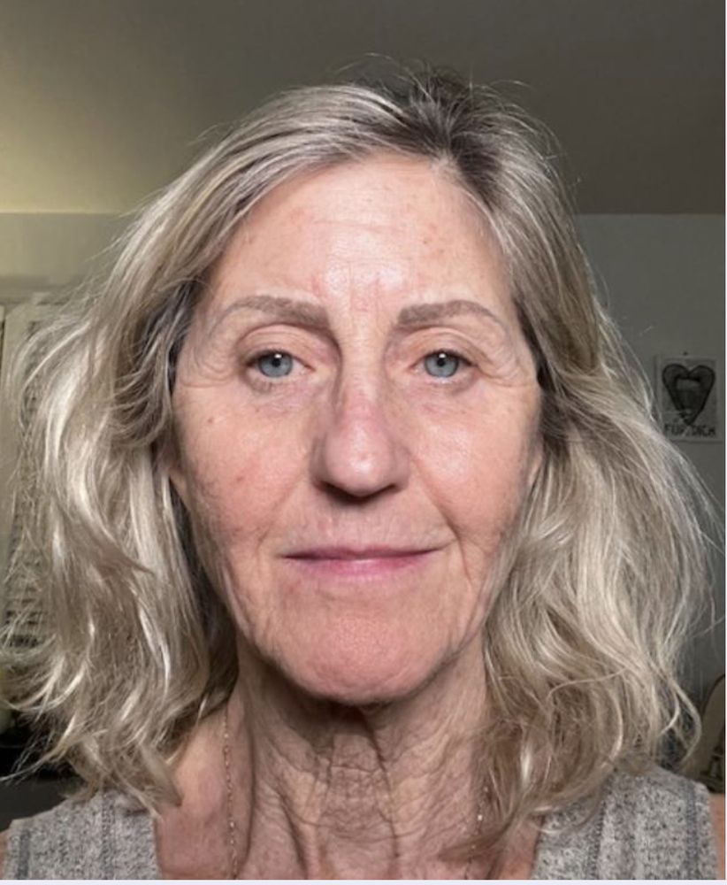 New Skin by Lynn Logo