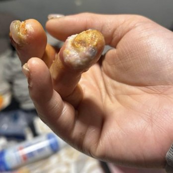 Avalon Nail Bar - My experience at this nail salon the worst of my life - Nail Salons Near Me - Long Beach, California