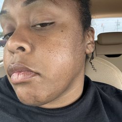 Day & Night Family Dental - Swelling on the way to referral