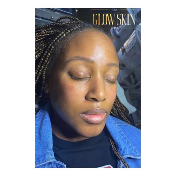 The Glow Skin Spa - Skin Care Near Me The Glow Skin Spa - Skin Care Near Me