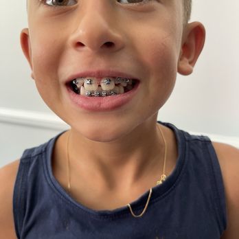 Orthodontics LA - Orthodontists Near Me - Encino, California