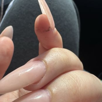 Hanny Nails & Spa - A gash that was made by the male worker - Nail Salons Near Me - San Diego, California Hanny Nails & Spa - A gash that was made by the male worker - Nail Salons Near Me - San Diego, California